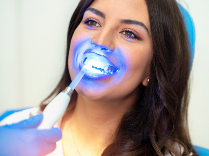 teeth whitening with our Dentist In Redmond