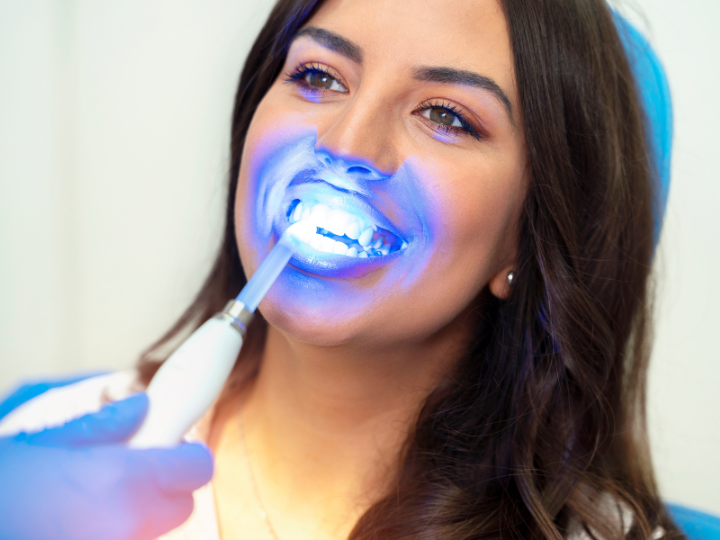 Whitening Treatment - Jay Gronemeyer, DMD - Redmond, OR Dentist Near Me